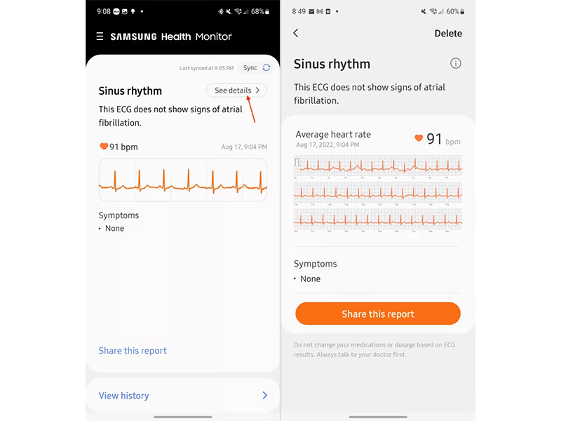 چگونه نوار قلب ضبط شده با سنسور ECG گلکسی واچ 5 را مشاهده کنیم؟